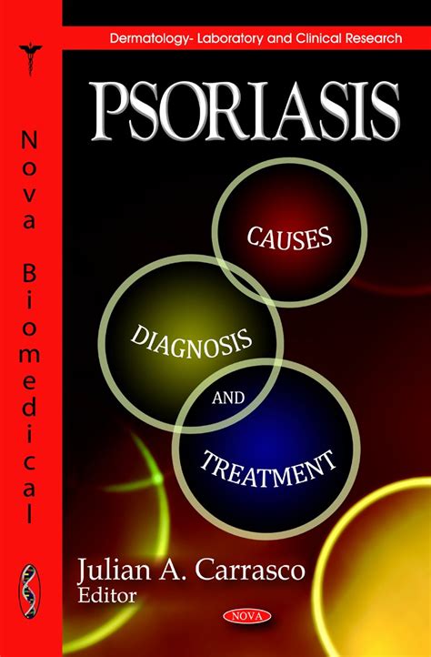 Buy Psoriasis: Causes, Diagnosis & Treatment (Dermatology - Laboratory ...