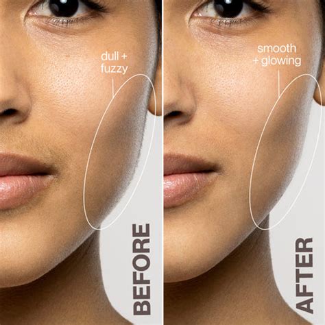 How to Use DermaFlash 的图像结果