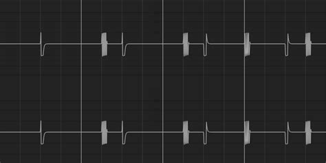 Trying to wrap my head around NEI trig conditions - Digitone/Digitone ...