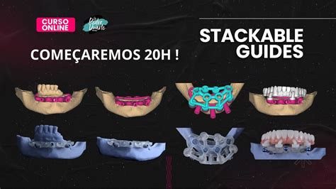 Image result for Stackable Guide Dailymotion