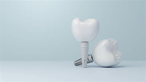 Explore Your Dental Implant Options | A Comprehensive Guide