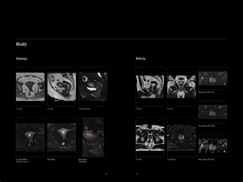 3.0 T MRI – Ultra wide Bore (75 cm) – GIC Prime