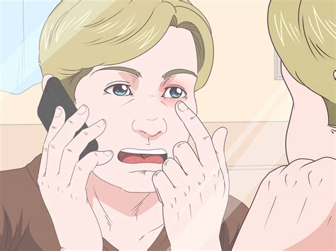 Image result for Problem Blob Eye Out