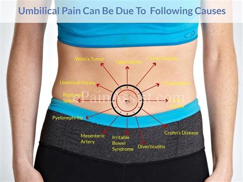 diverticulitis pain location