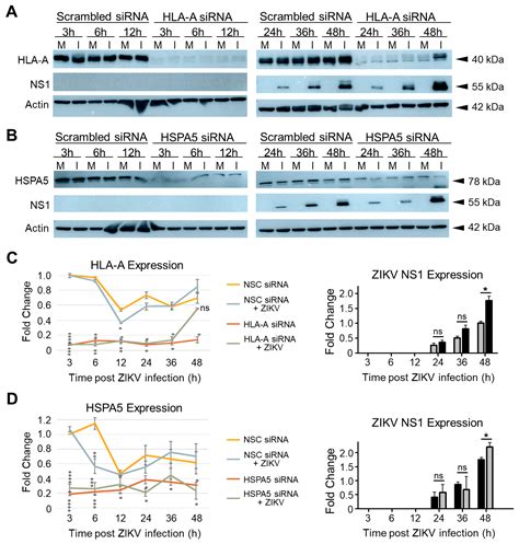 HLA-A, HSPA5, IGFBP5 and PSMA2 Are Restriction Factors for Zika Virus ...