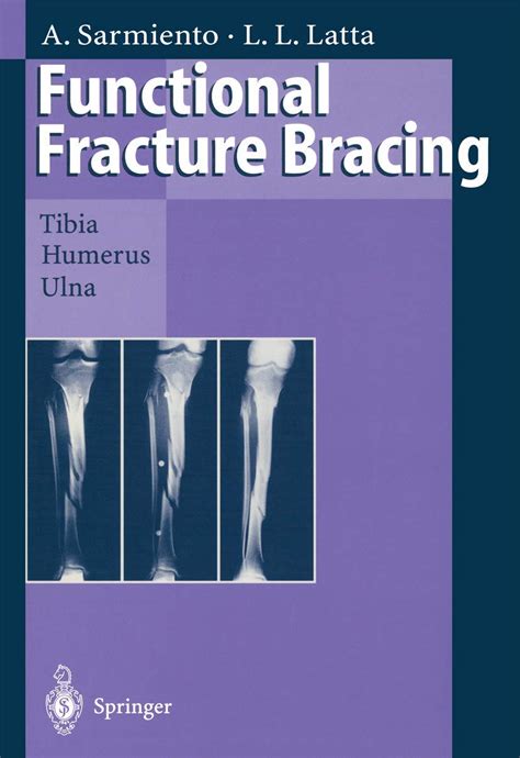 Buy Functional Fracture Bracing: Tibia, Humerus, and Ulna Book Online ...