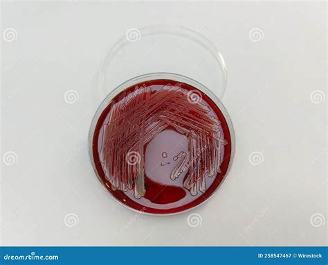 Staphylococcus Aureus Bacteria Displayed on Blood Agar Plate on a White ...