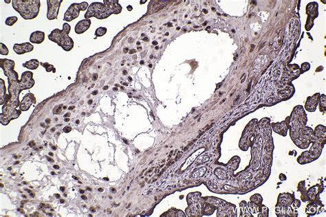 RAN antibody (10469-1-AP) | Proteintech