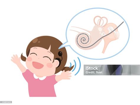 Image result for Cochlear