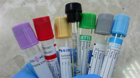 Image result for Test-Tube Sample