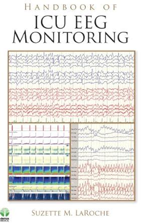 Handbook of ICU EEG Monitoring eBook : LaRoche MD, Suzette, Suzette MD ...