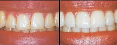 Dental Joy Hi-Tech Dental Clinic