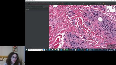 Image result for QuPath Basics