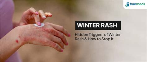 Heptral 400 MG | Order Heptral 400 MG Tablet Online at Truemeds