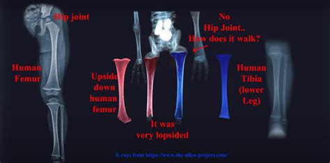 Alien X-ray 的图像结果