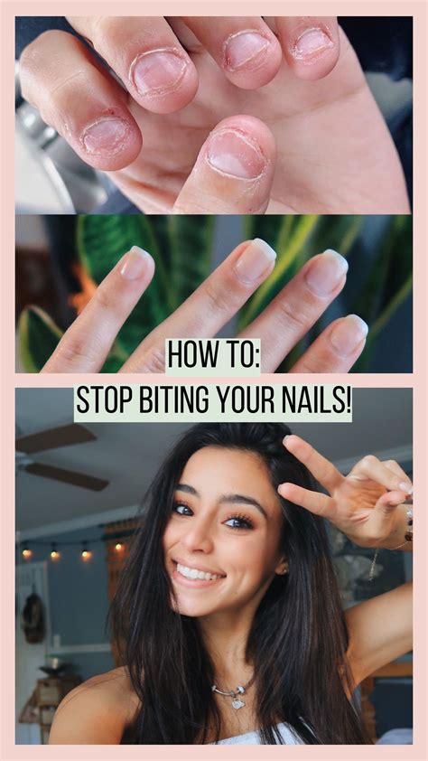 How to stop biting your nails for GOOD!! | Nail biting remedies, How to ...
