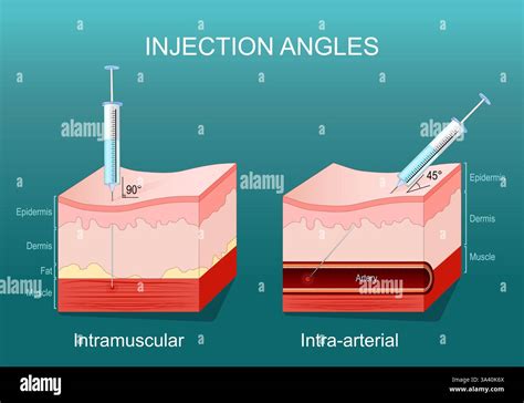 Intramuscular Injection Needle 的图像结果