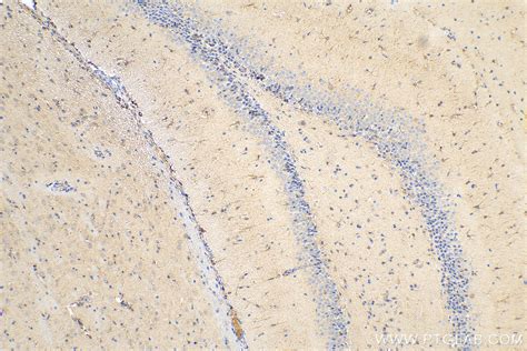 iNOS antibody (80517-1-RR) | Proteintech