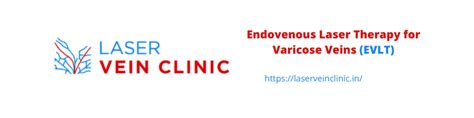 Endovenous Laser Therapy for Varicose Veins (EVLT) - Laser Vein Clinic
