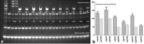 Rezultat imagine pentru Trapeze Method