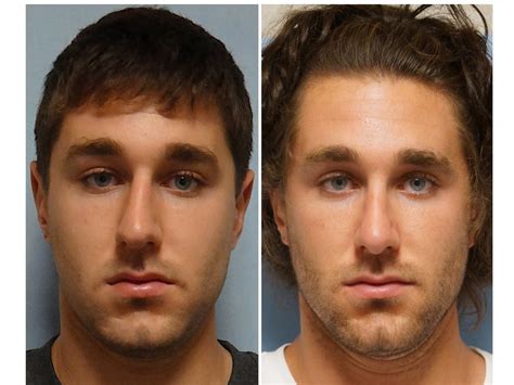 Facial Plastic Surgery: Male rhinoplasty, Cosmetic rhinoplasty, Nose job, Crooked nose, Nasal ...