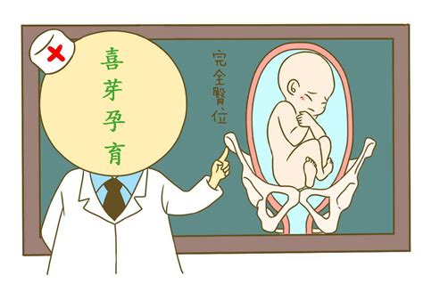 胎儿臀位该如何选择分娩方式？一定要剖腹产吗？_凤凰网健康_凤凰网