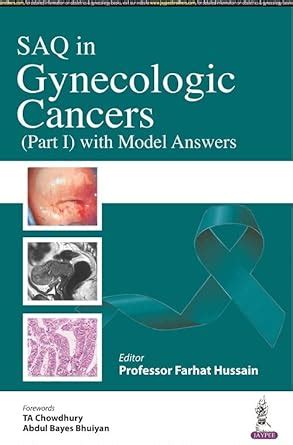 Buy SAQ IN GYNECOLOGICAL CANCERS (PART 1) WITH MODEL ANSWERS Book ...