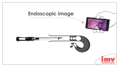 Image result for IMV Alpha Vision Tutorial