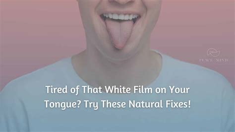 Tongue With White Film
