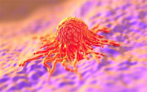 Image result for Cancer Detection Using Graph CNN