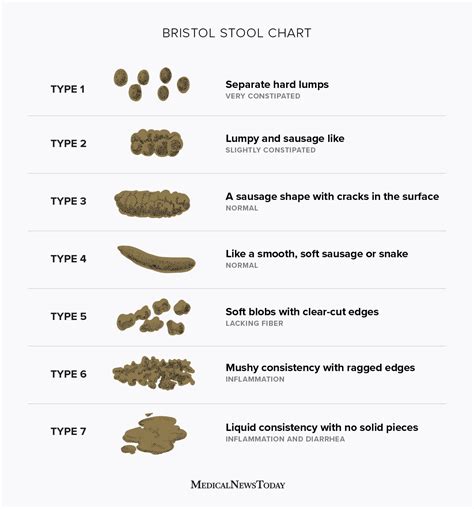 Stool Color Chart Human 的图像结果