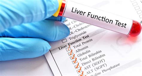 Image result for Liver Function Tests Chart