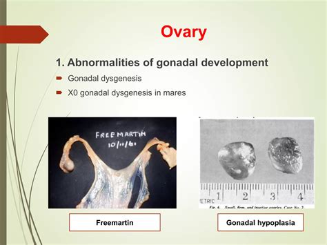 Reproductive System Disorders 的图像结果