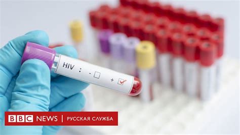 Новая вакцина против ВИЧ оказалась эффективной и безопасной - BBC News ...