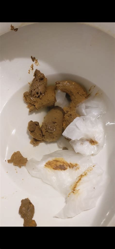 Exploding Poop Human 的图像结果