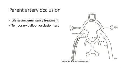 Carotid Cavernous Fistulas | PPTX