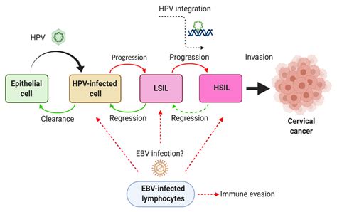Role of Epstein-Barr Virus and Human Papillomavirus Coinfection in ...