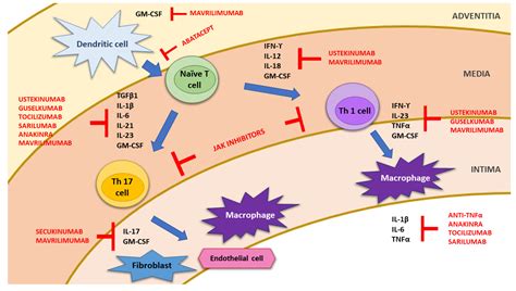 Advances in the Treatment of Giant Cell Arteritis