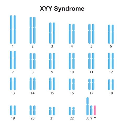 Who Discovered Xyy Syndrome