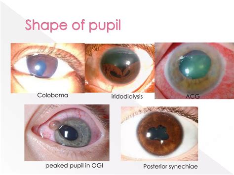 Image result for Competitive Overview Slide Example
