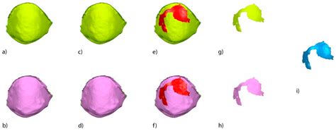 A Repeatable and Reproducible Digital Method to Quantify the Cement ...