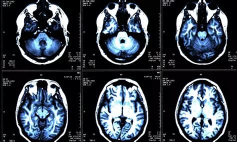 New method for image reconstruction in electrical impedance tomography