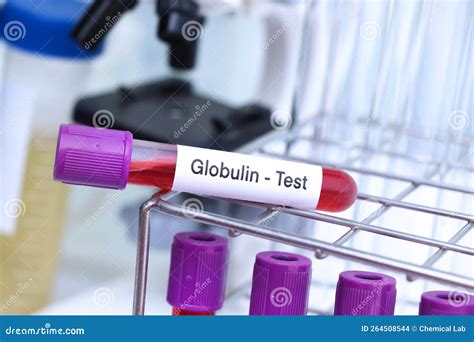 Globulin Test To Look for Abnormalities from Blood Stock Photo - Image ...