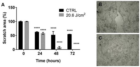Photobiomodulation of Human Fibroblasts and Keratinocytes with Blue ...