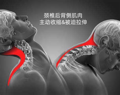 中医大师手把手教你“拿肩井，颈项”推拿按摩 治疗颈椎疾病手法_腾讯视频