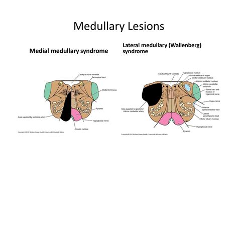 Brainstem & Diencephalon - ppt download