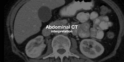 Image result for Cystogram Procedure for CT Scan