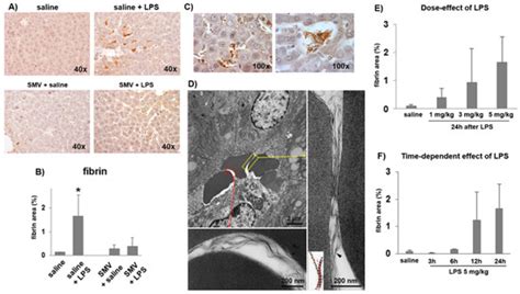 Simvastatin Prevents Liver Microthrombosis and Sepsis Induced ...