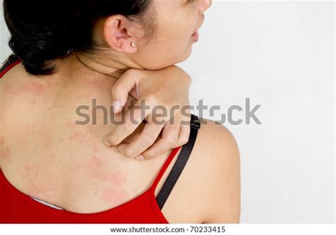Image result for Intense Back Scratching