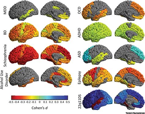 The foundation and architecture of precision medicine in neurology and ...